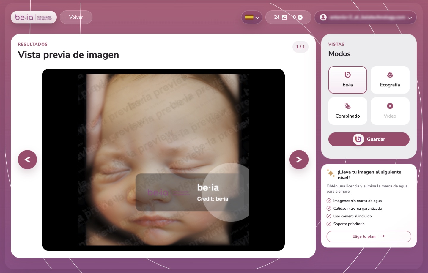 Be·ia web app for uploading ultrasounds