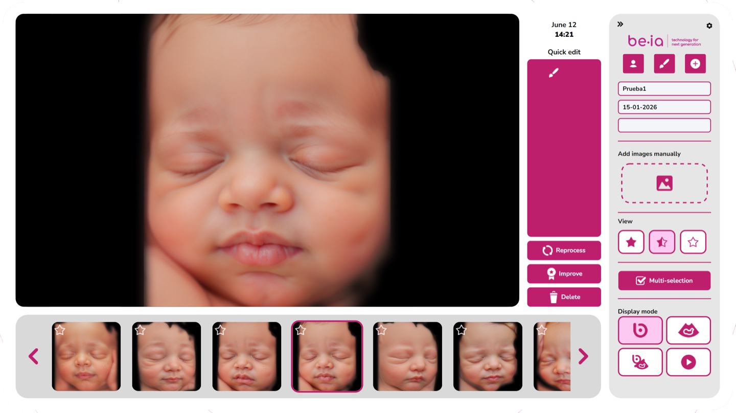 Be·ia web app for uploading ultrasounds