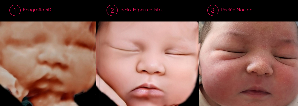 ecografia hiperrealista be·ia con recién nacido 7