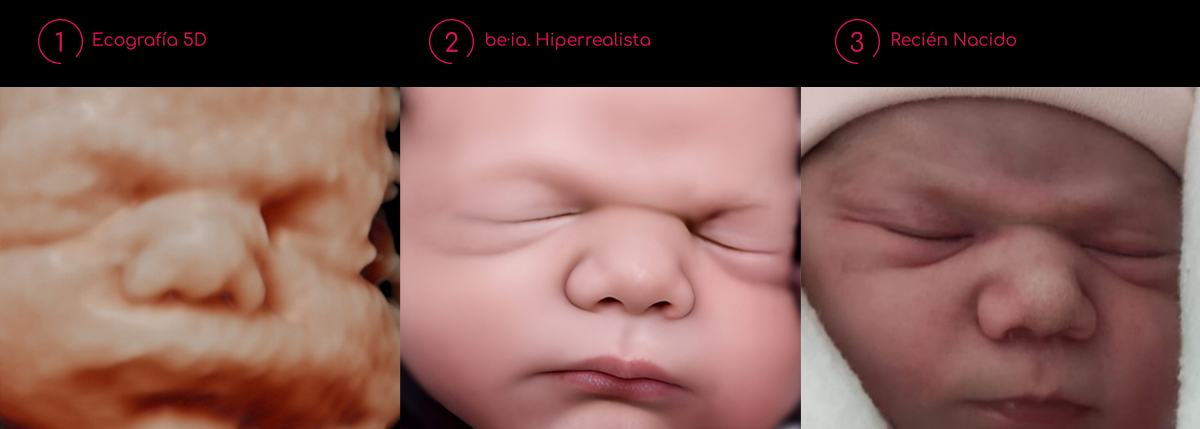 ecografia hiperrealista be·ia con recién nacido 1