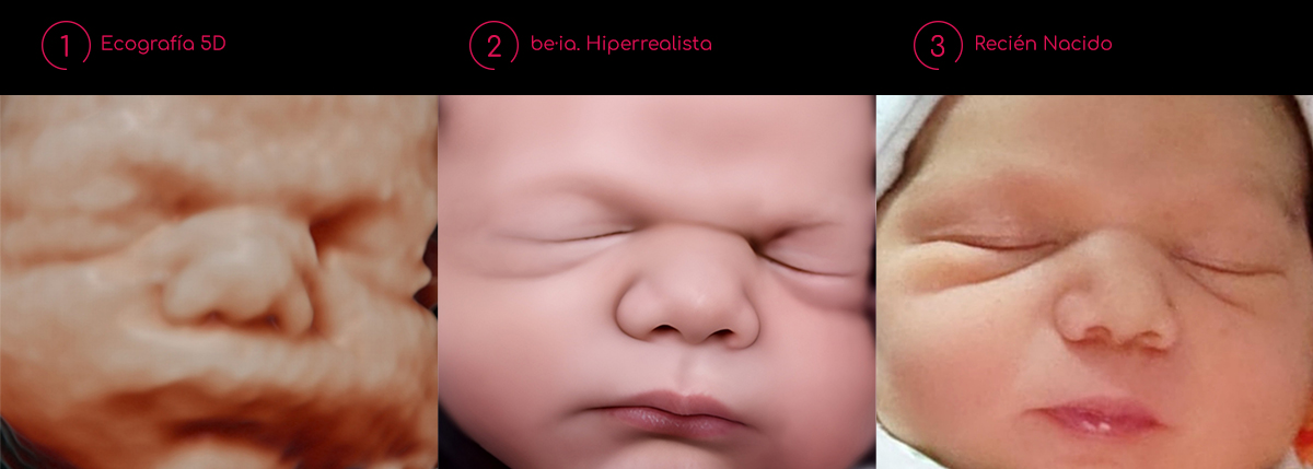 ecografia hiperrealista be·ia con recién nacido