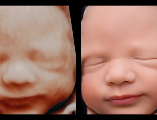 Beyond 8K Ultrasounds: Discovering the Wonder of Be·ia’s Hyperrealistic Images
