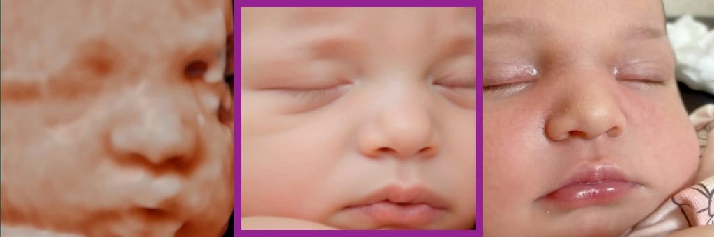 integración software